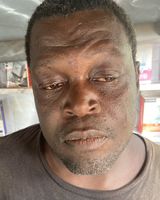 Asare0249
